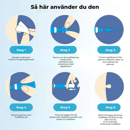 ClearSkin™ Penn – Säker borttagning av hudmärken!